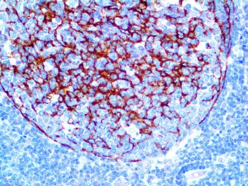 IHC of CLusterin/Apoliprotein J on an FFPE Tonsil Tissue